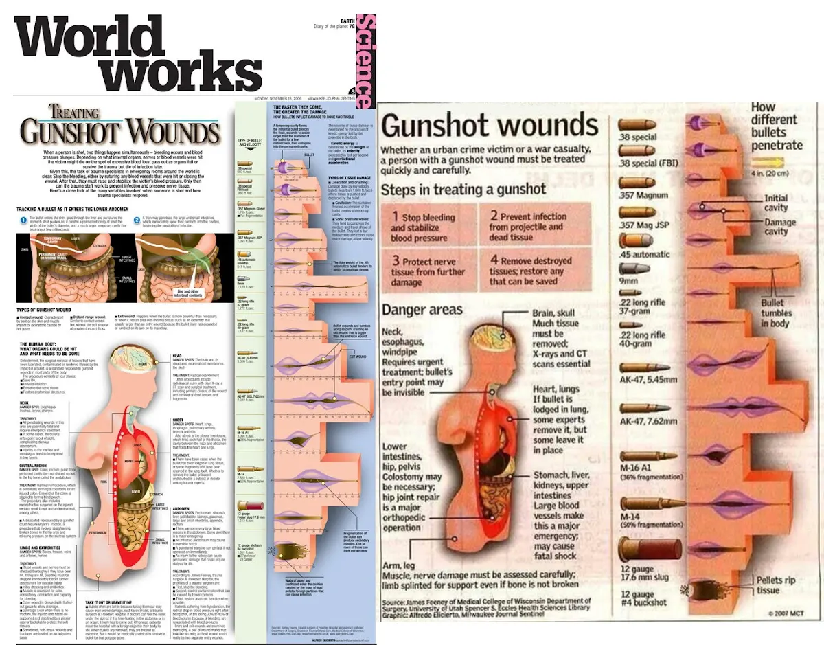 Gunshot Wounds